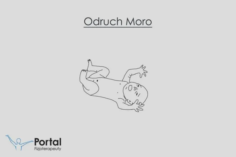 Odruch moro